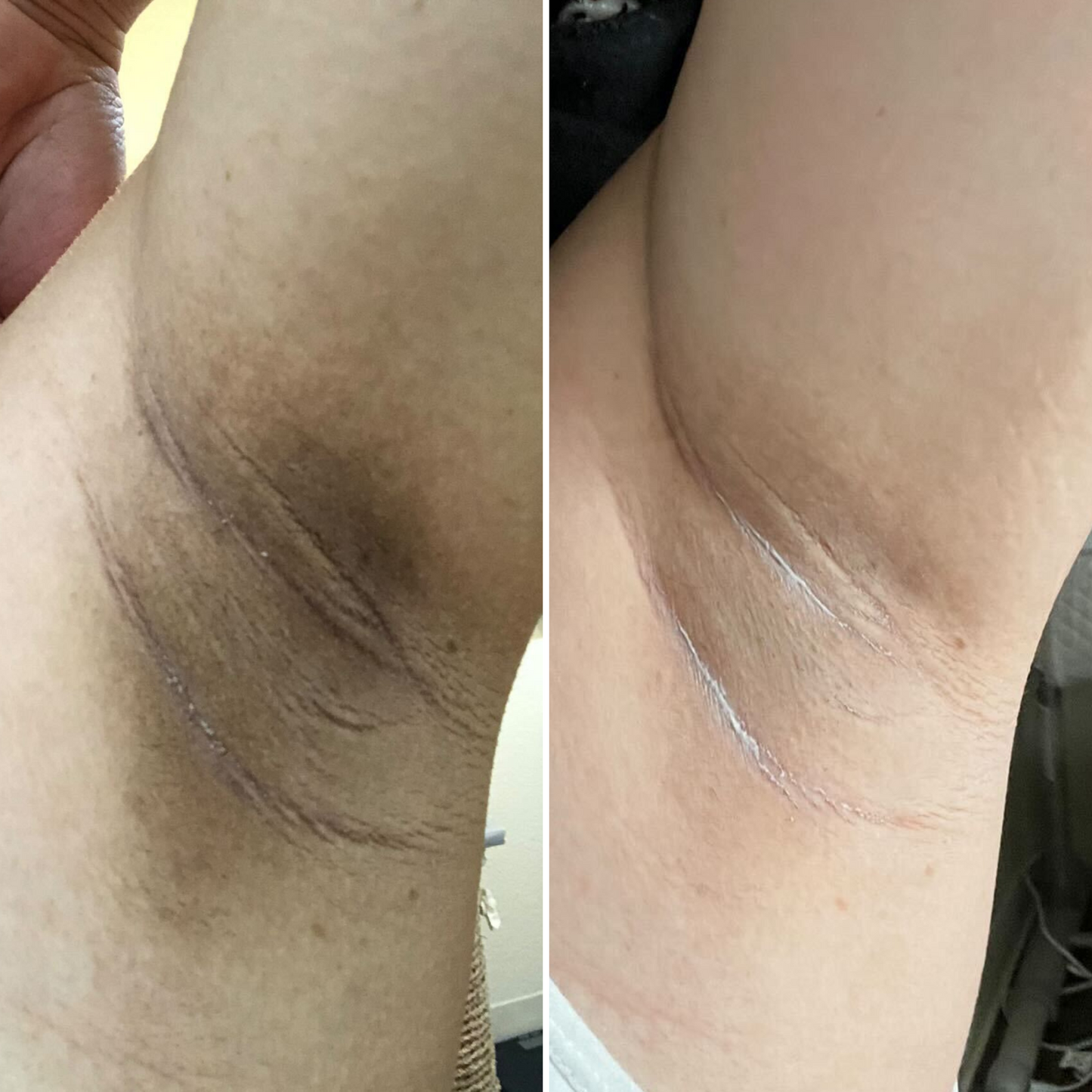 Dark Spot Oil - Bermuda